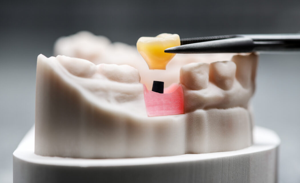 BLEND3 Fotografie, Fotograf Frank Grätz, Dresden, Variodental